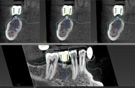 Braun Dentalis Berlin Zahntechnik - Implantattechnik